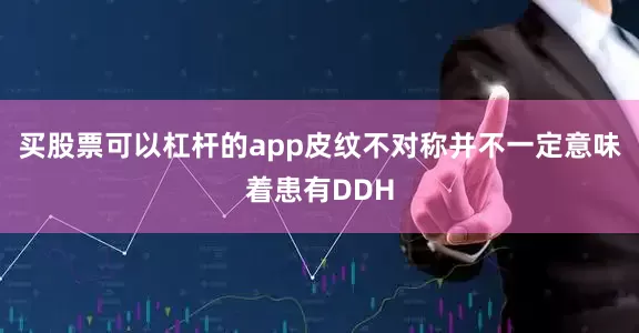 买股票可以杠杆的app皮纹不对称并不一定意味着患有DDH